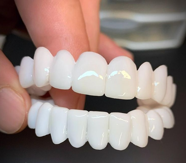 Comfortable Dental Veneers for Perfect Smile - Halri