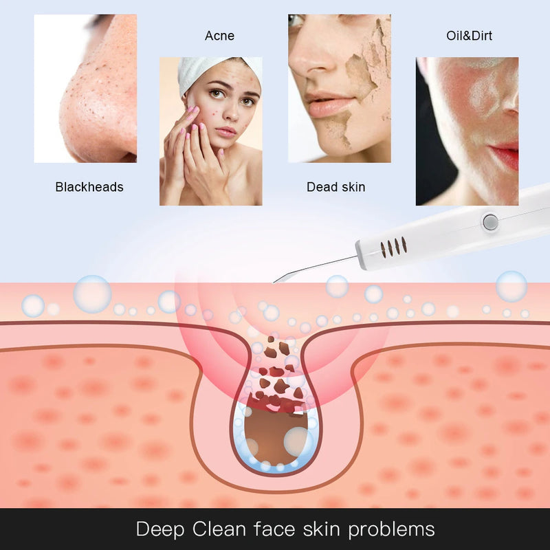Advanced Facial Cleansing Brush for Pore Deep Cleaning