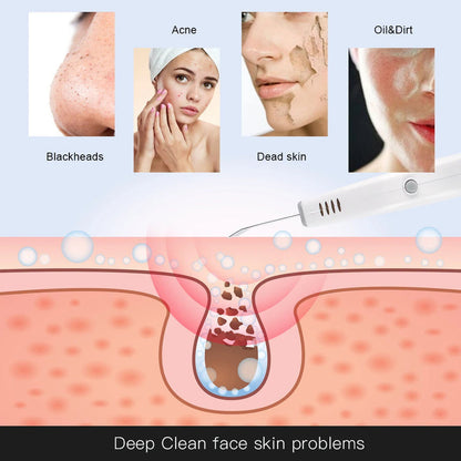 Advanced Facial Cleansing Brush for Pore Deep Cleaning
