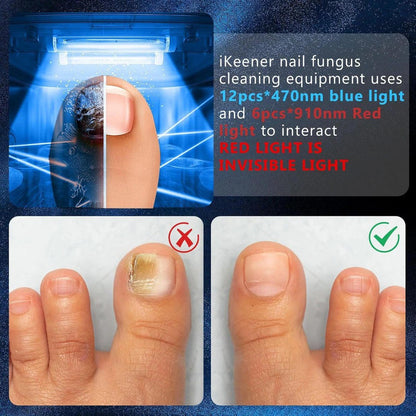 Effective Toenail Fungus Remover