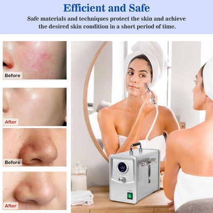 Advanced Diamond Skin Exfoliation Facial Device