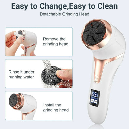 Easy Foot Callus Remover Kit for Smooth Skin