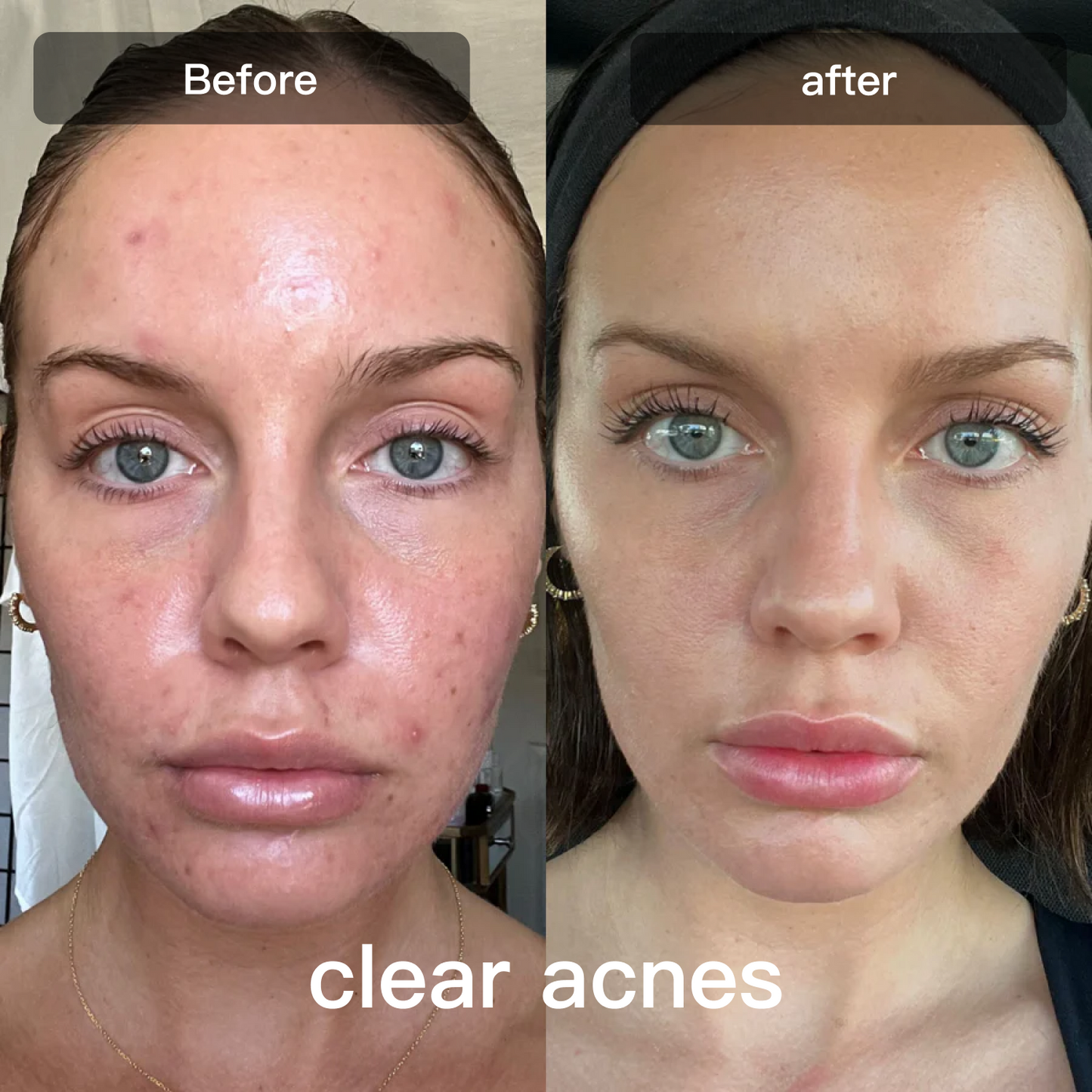 Advanced 7 Color LED Skin Care Device